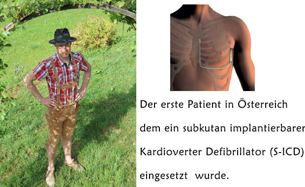 Stefan Pötz ist der erste Österreicher, dem ein subkutan implantierbarer Kadioverter Defibrillator, S-ICD, eigesetzt worden ist.